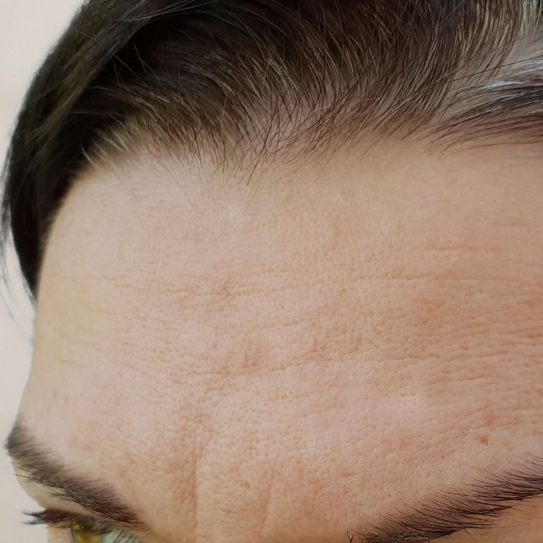 avant centre anti age (21)