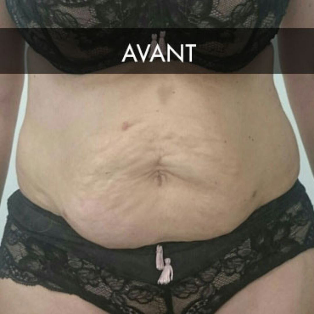 55