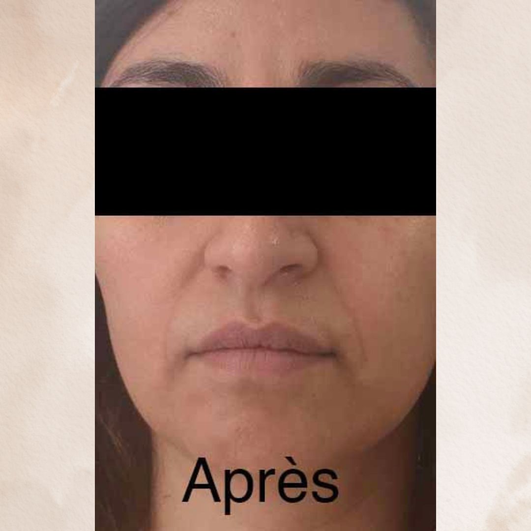xr:d:DAGB7tanUr4:28,j:3729404934445430002,t:24041015